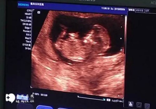 2023年徐州第一人民醫(yī)院試管嬰兒攻略，內(nèi)附成功率與費(fèi)用構(gòu)成！_1