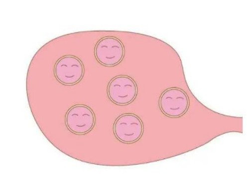 寧波試管嬰兒價(jià)格：怎樣解決子宮肌瘤帶來的困擾？