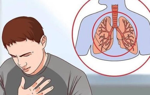 剖宮產(chǎn)后收腹帶需要戴多久？附佩戴時(shí)間及注意事項(xiàng)_1