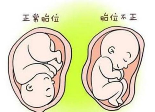 寧波助孕：三代篩查不合格仍然想要移植？能夠接受這些風(fēng)險就可以繼續(xù)