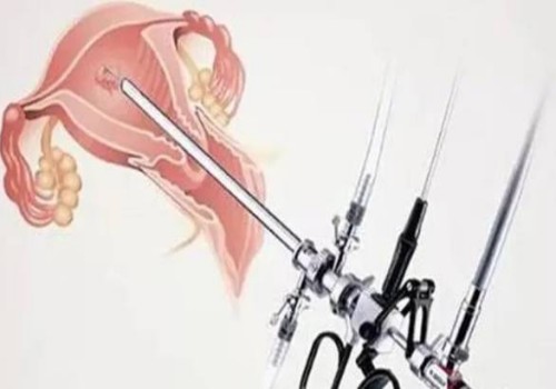 單身女性不要只看凍卵的利端，只要是手術(shù)就會有利弊