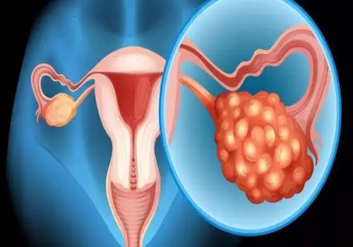 寧波試管助孕價格：怎樣通過孕檢單判斷胎兒性別？教你正確看懂孕檢單