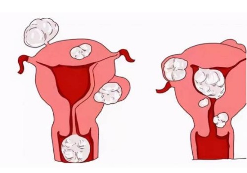 寧波助孕機(jī)構(gòu)：四維彩超也能看出胎兒性別，男孩女孩有這四方面區(qū)別