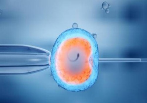 羊水穿刺染色體報告解讀：是男孩還是女孩一目了然！