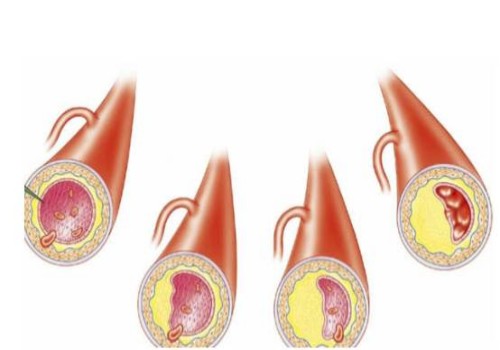 寧波供卵試管：超詳細(xì)的試管嬰兒移植全流程分享，從開(kāi)始到成功只需要五步